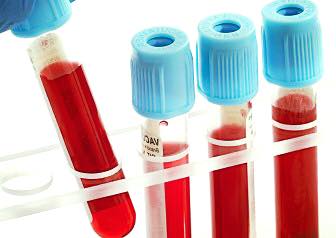 Free research on glycated hemoglobin and endocrinologist consultation for the population