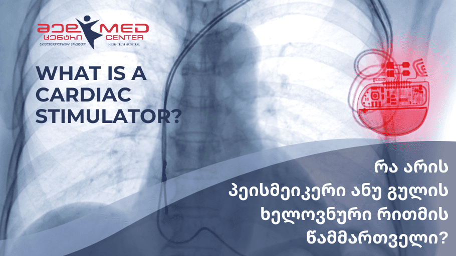 What is a cardiac stimulator?