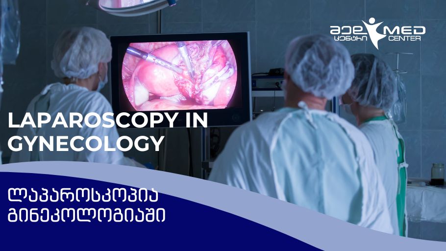 Laparoscopy in Gynecology: Modern Methods of Diagnosis and Treatment